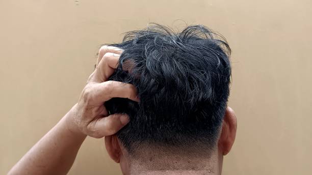 O-que-é-shampoo-escurecedor